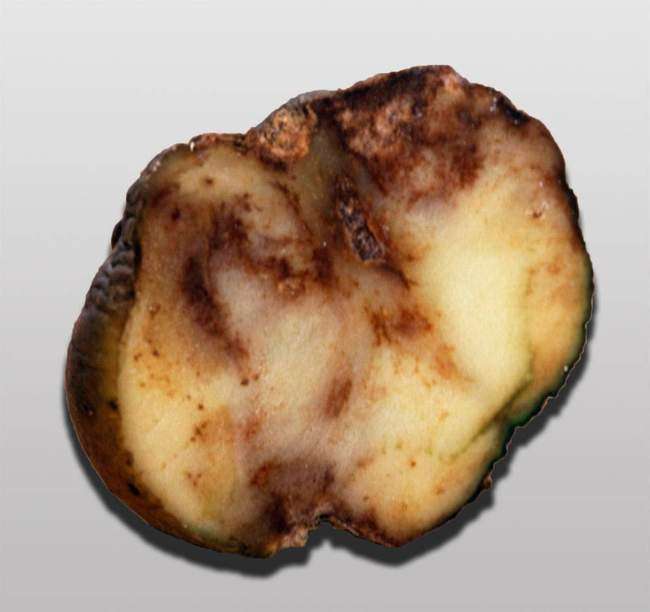 Болезни картофеля: Бурая гниль или Фитофтороз